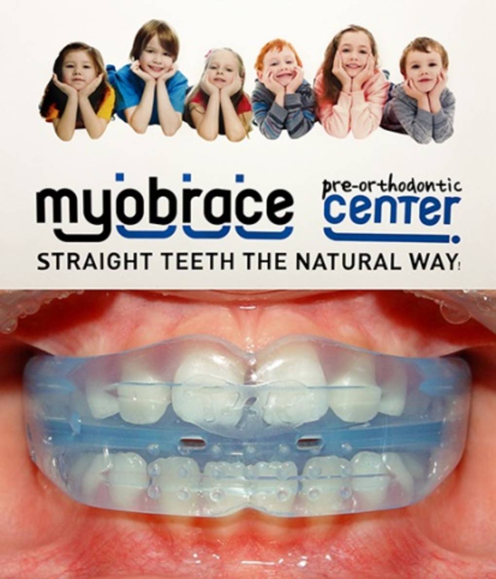 Myobrace Lingewaard Tandartsen Myobrace Lingewaard Tandartsen